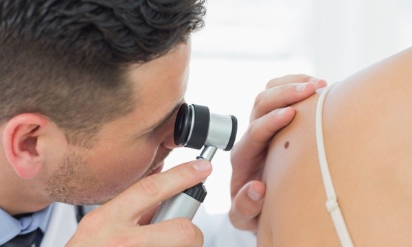 Prevenire è meglio che curare…Visita dermatologica e mappatura dei nei in epiluminescenza in centro dal Dott.Riziero Zamboni!