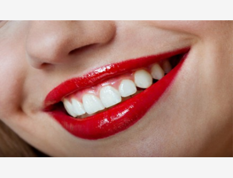 Aperta ad Agosto! Novità! Seduta igiene orale e smacchiamento con Air-Polishing e trattamento rimineralizzante anticarie. Ritrova il tuo sorriso naturale a Genova Sampierdarena in via Cantore!