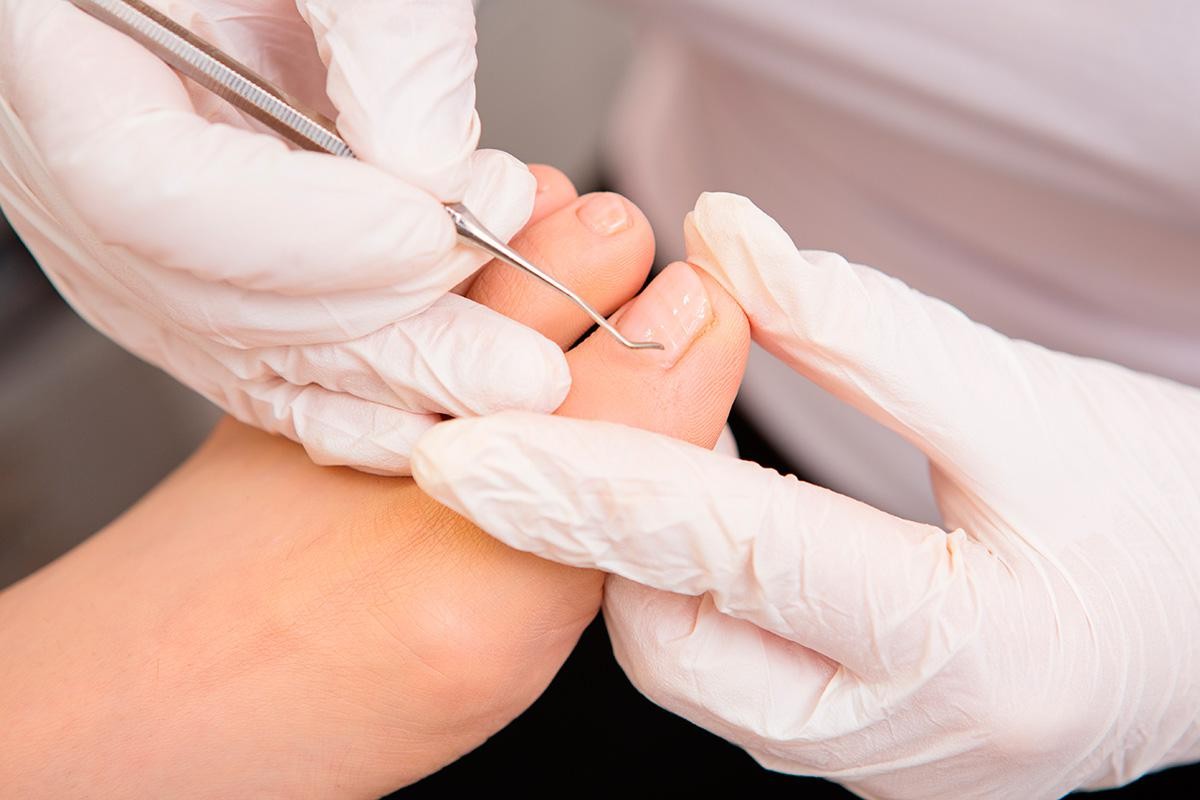  Trattamento podologico a due passi dal centro! Affidati all’esperienza della Dottoressa Doro Fiorella! Il benessere parte dai piedi!